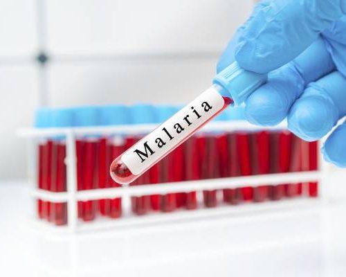 Malaria to choroba zagrażająca życiu. Możesz się nią zarazić podczas egzotycznej podróży. Sprawdź, jakie są objawy malarii