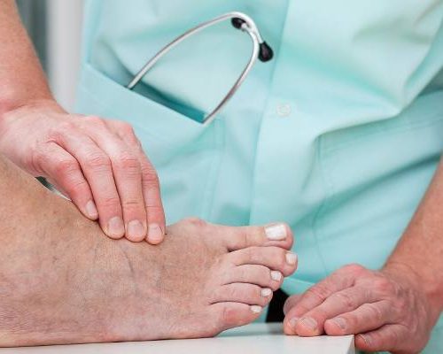 Objawy choroby Alzheimera są widoczne na stopach. Po tych zmianach poznasz, że rozwija się demencja. Wykryj i zacznij leczyć
