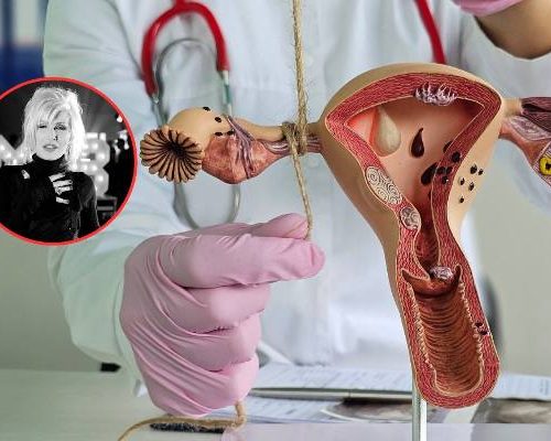 Kora latami żyła z bólem. Diagnoza przyszła za późno. To jeden z najgroźniejszych nowotworów u kobiet