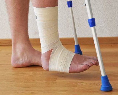 Czym się różni zwichnięcie od skręcenia? Jak leczyć zwichnięcie kostki, barku i nadgarstka?